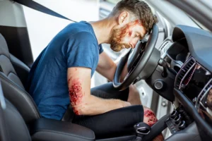 Blunt Force Trauma Car Accident Compensation
