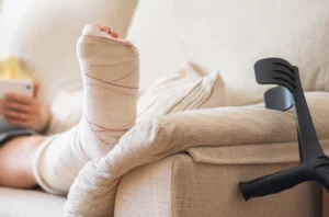 Traumatic Amputation Injuries Your Legal Rights After a Catastrophic Accident in Downey, CA